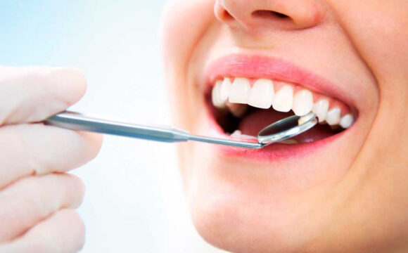 Estética Dental